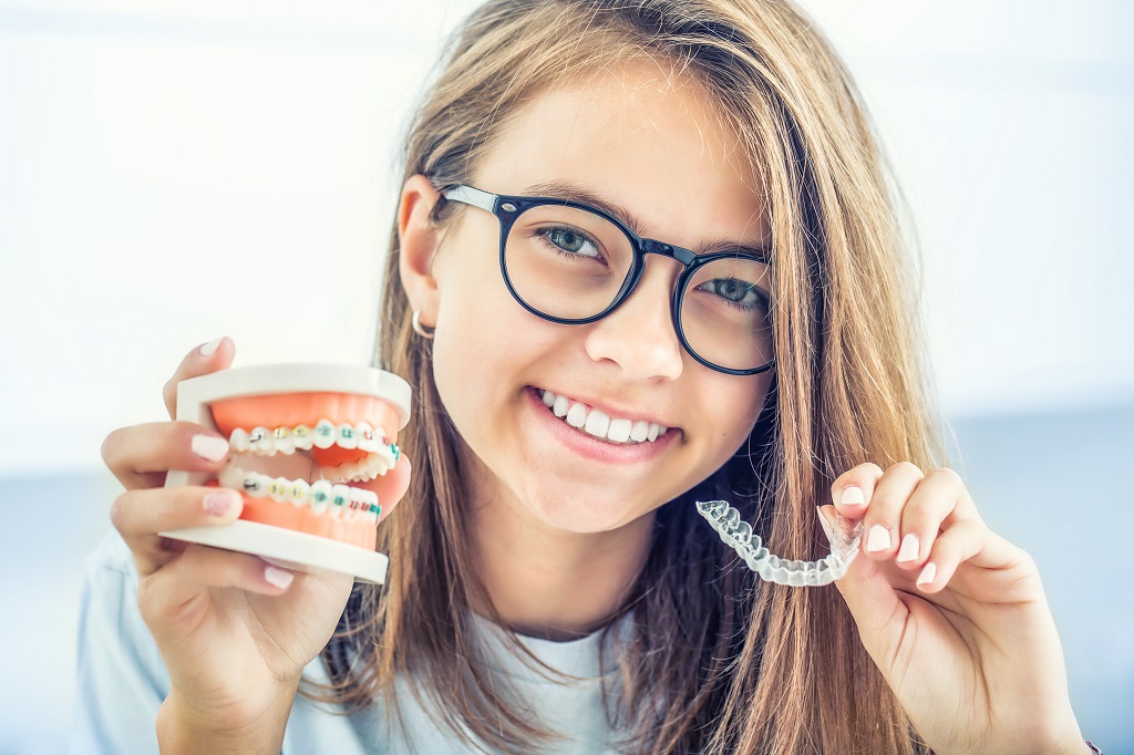 Clear Aligners