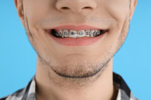 Are Braces Painful? 7 Things You Need to Know