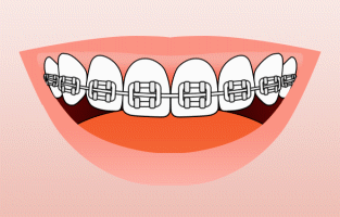 Freehold Orthodontics Brushing With Braces